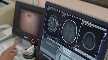 A new method for diagnosing cancer has been developed by a professor at the Belarusian State Medical University