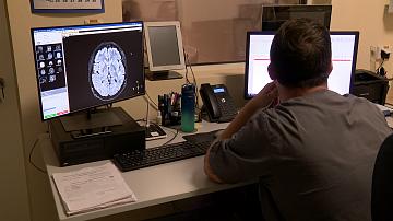 Belarusian doctors report an increase in strokes
